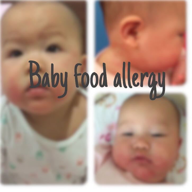 FOOD ALLERGY Part 2 -BABY image