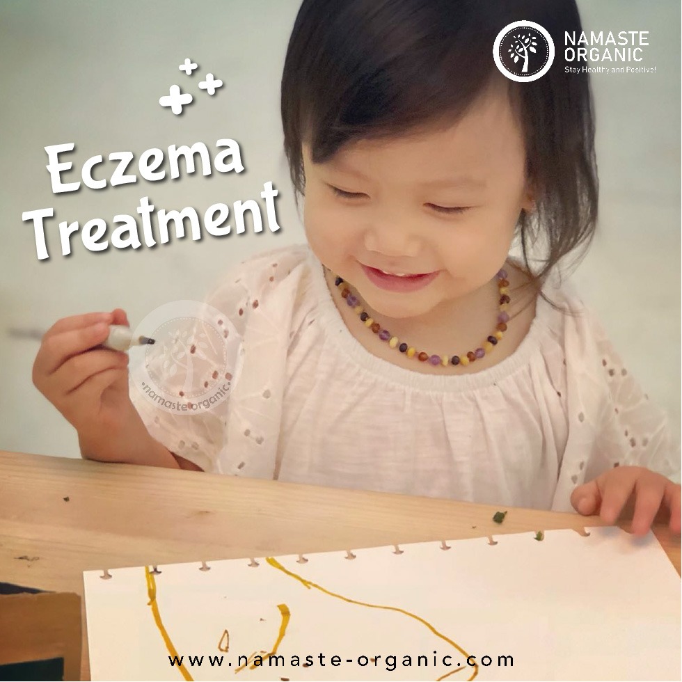 Emma's Eczema Story part 2 (Treatment) image